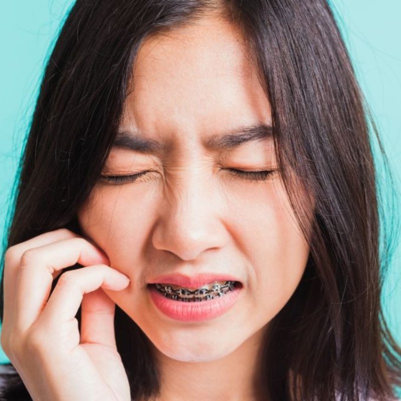Niềng răng có đau không là vấn đề khách hàng quan tâm hàng đầu