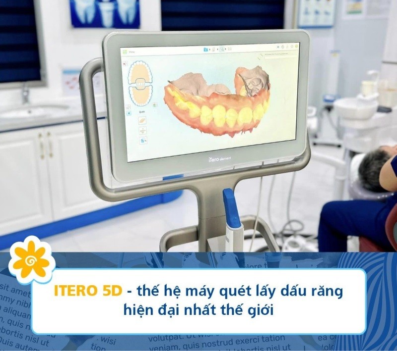 Máy iTero 5D quyết dấu răng hiện đại