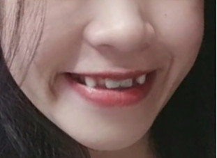 https://drthainguyen.com/wp-content/uploads/2024/01/z5101628922780_8004583a5f914dd10839e2a4f7a44231.jpg