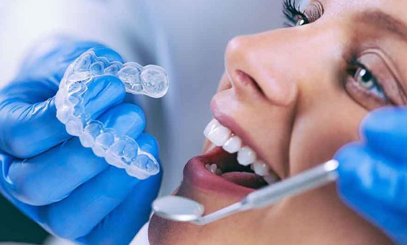 Tay nghề bác sĩ ảnh hưởng đến mức độ đau khi niềng răng Invisalign