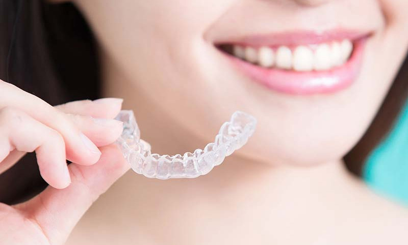 Có nên niềng răng Invisalign trả góp để giảm gánh nặng tài chính