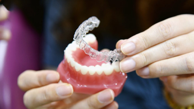 Có Nên Niềng Răng Invisalign Trả Góp Không? Giải Đáp Chi Tiết