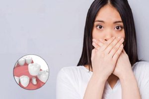 Trồng Răng Implant Có Bị Hôi Miệng Không? Bác Sĩ Giải Đáp