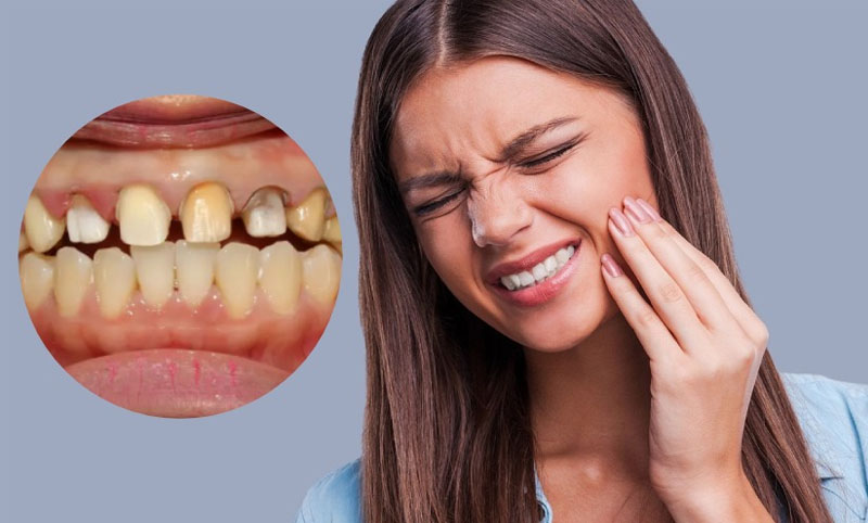 Bọc răng sứ có đau không là thắc mắc của nhiều khách hàng
