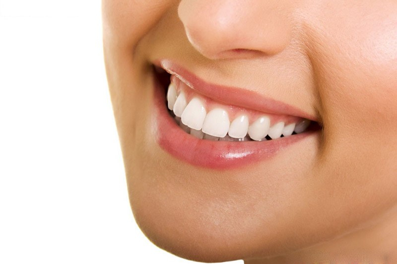 Răng sứ có độ bền cao khoảng từ 10 - 15 năm