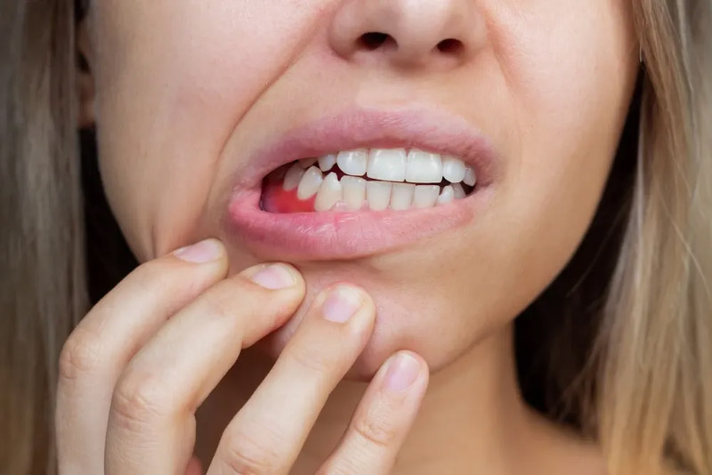 Nếu sử dụng răng sứ không rõ nguồn gốc có thể bị viêm nướu và tụt lợi