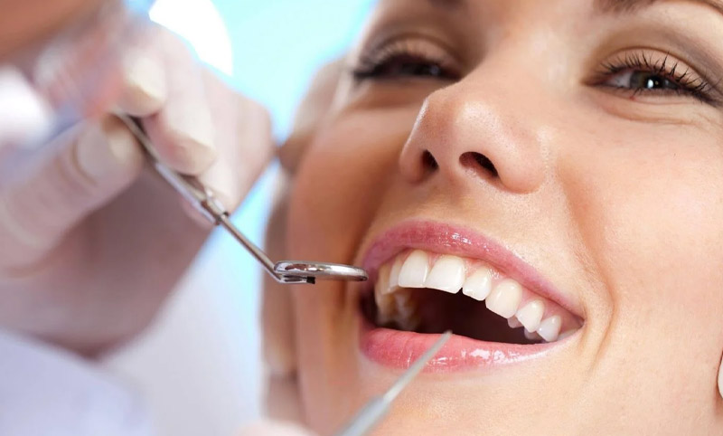 Bọc răng sứ mất thời gian khoảng 3 - 5 ngày để hoàn thành