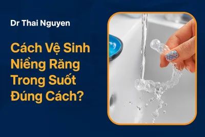 Cách Vệ Sinh Niềng Răng Trong Suốt