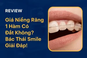 giá niềng răng 1 hàm có đắt ko